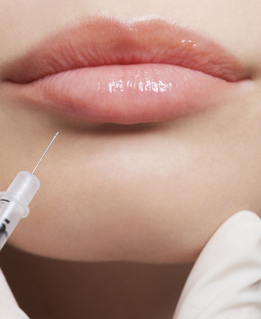 Close up of woman receiving botox injection in lips